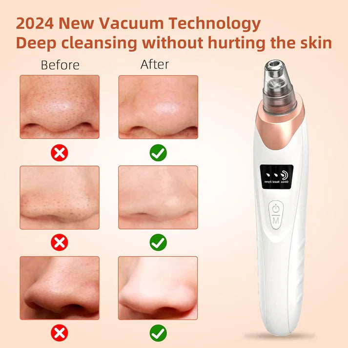 White Pore Cleaner - Skin Care Tool