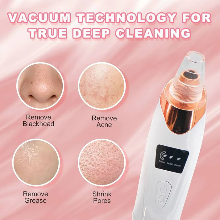 White Pore Cleaner - Skin Care Tool